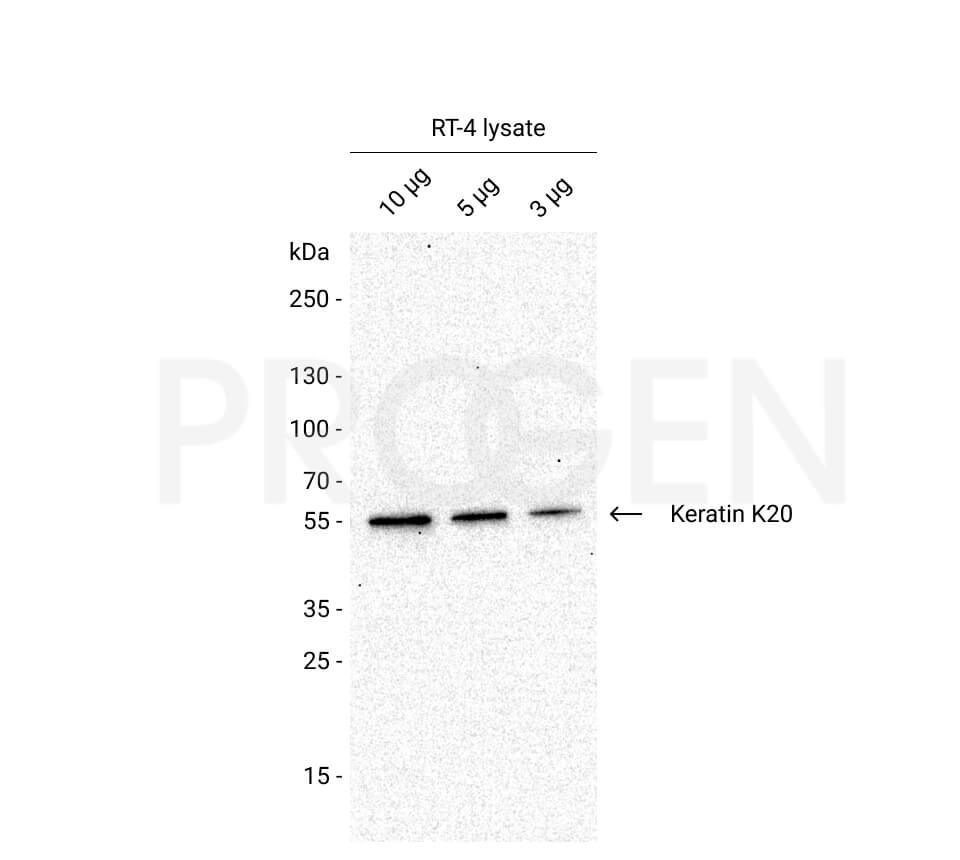 anti-Keratin K20 mouse monoclonal, IT-Ks20.8, liquid, purified, sample