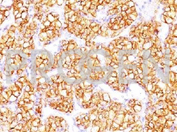 anti-Renal Cell Carcinoma Marker (CD205) mouse monoclonal, PN-15, purified