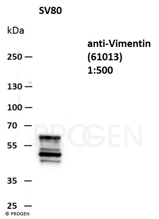Positive western blot control: anti-Vimentin antibody