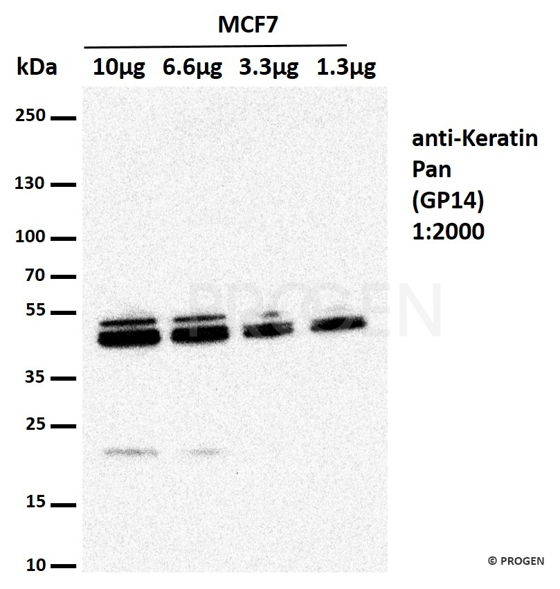 Positive western blot control: anti-Keratin pan antibody