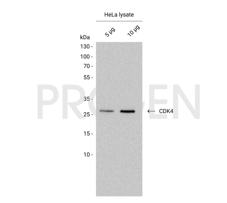 anti-Cyclin-Dependent Kinase 4 mouse monoclonal, DCS-156, liquid, purified, sample