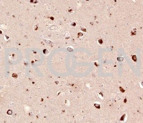 anti-CD13 mouse monoclonal, EBS-CD-012, purified