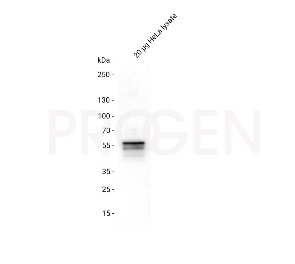 anti-Keratin Type II mouse monoclonal, Ks pan1-8, lyophilized, purified