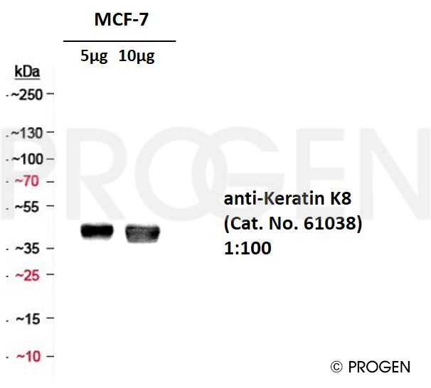 anti-Keratin K8 mouse monoclonal, Ks8.7, liquid, purified