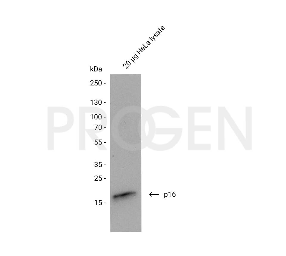 anti-p16 Protein mouse monoclonal, DCS-50, lyophilized, purified