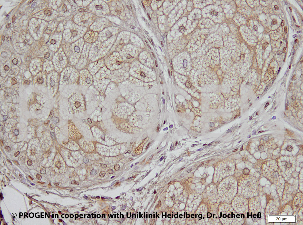 anti-Perilipin 2 (mouse N-terminus) guinea pig polyclonal, serum