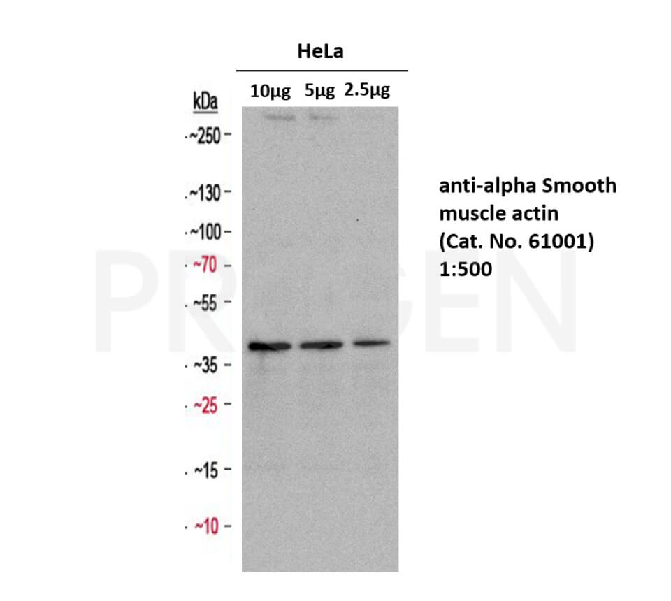 anti-alpha-Smooth Muscle Actin mouse monoclonal, 1A4/ASM-1, liquid, purified, sample