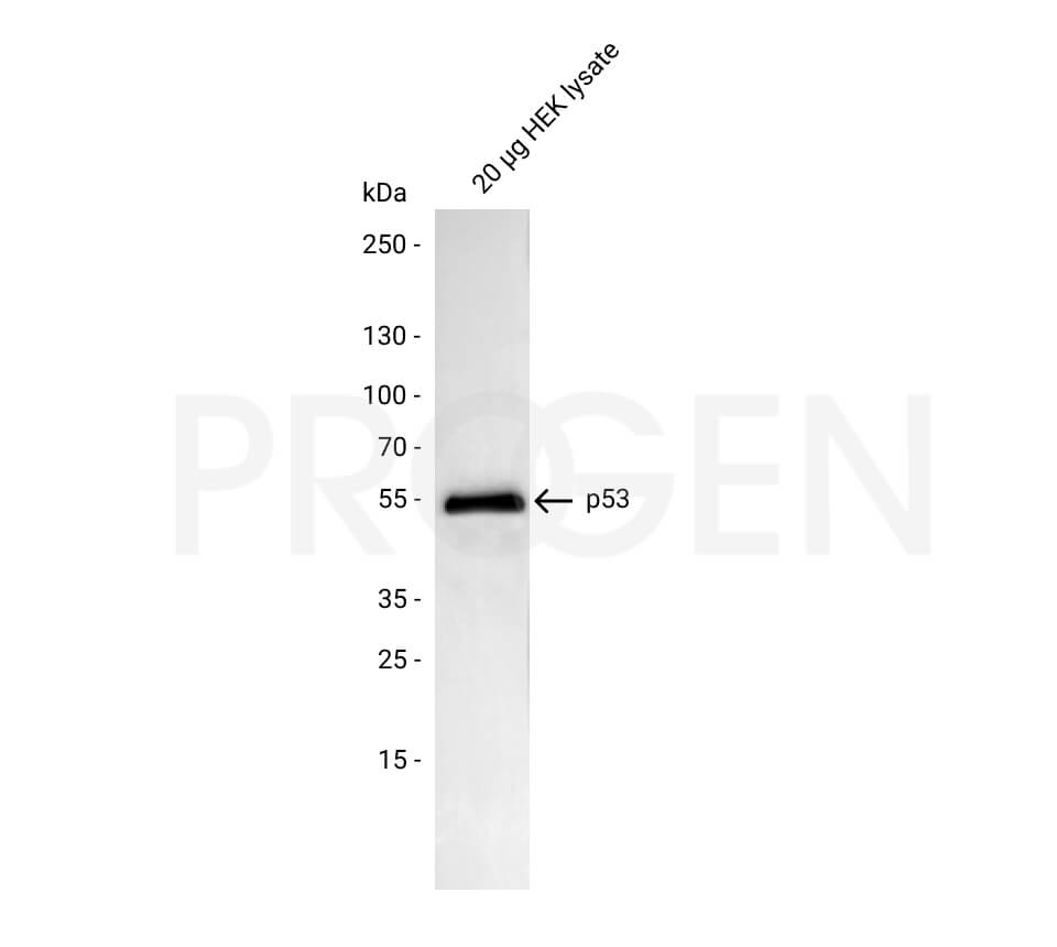 anti-p53 Protein mouse monoclonal, Bp53.11, lyophilized, purified