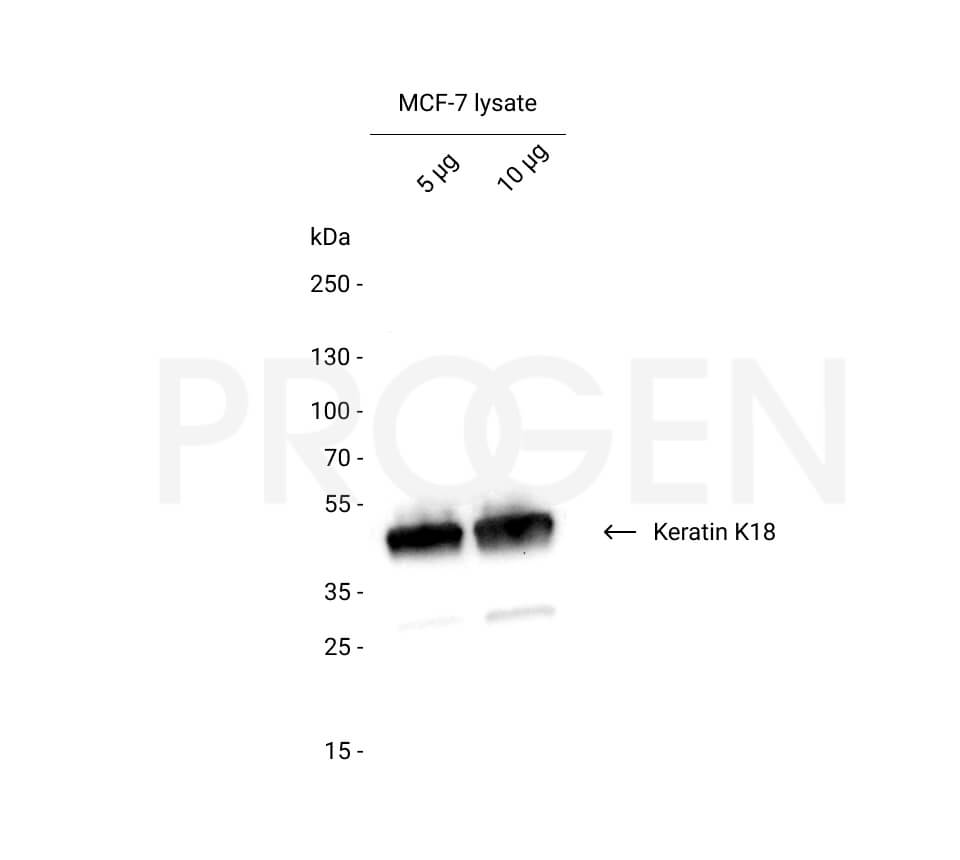 anti-Keratin K18 mouse monoclonal, Ks18.04, liquid, purified 