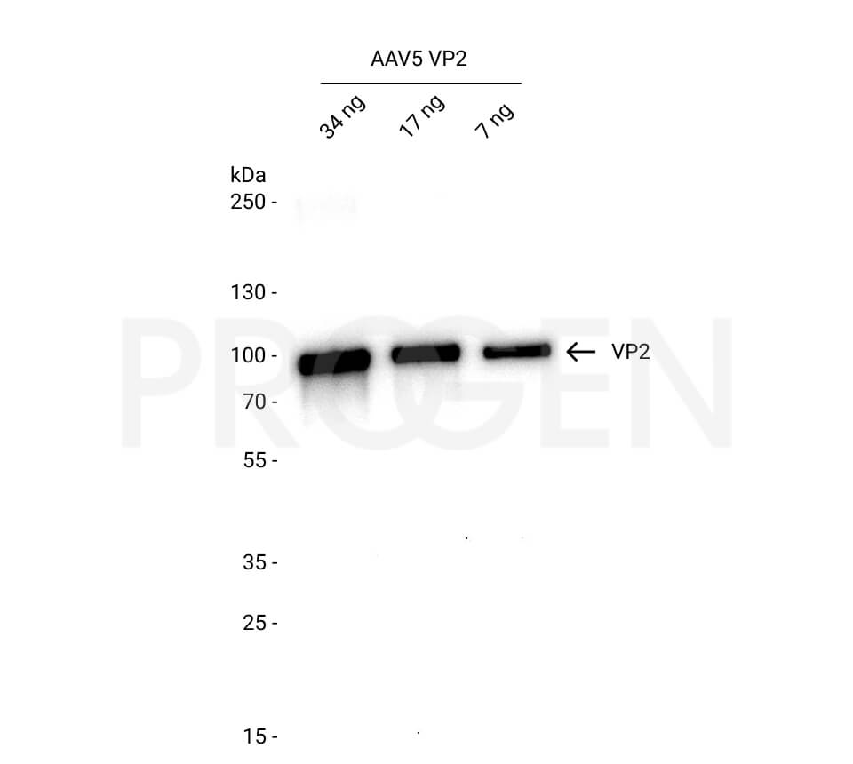 AAV5 VP2, recombinant protein