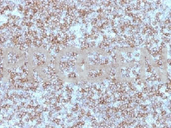 anti-MHC II DP+DR (beta chain) mouse monoclonal, Bra14, purified
