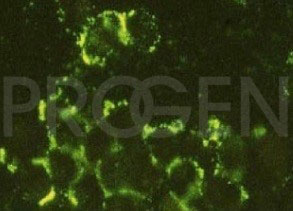 anti-Rabies Virus mouse monoclonal, RAb-50, purified
