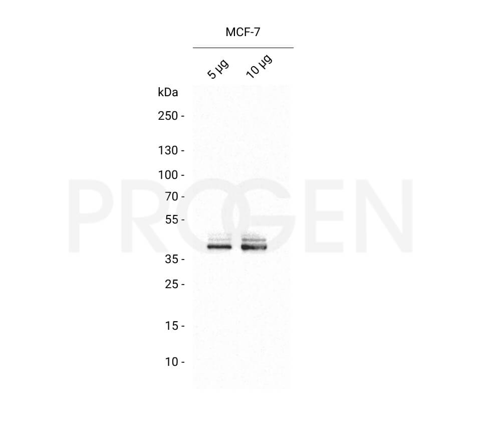 anti-Keratin K19 mouse monoclonal, Ks19.1 (A53-B/A2), liquid, purified, sample