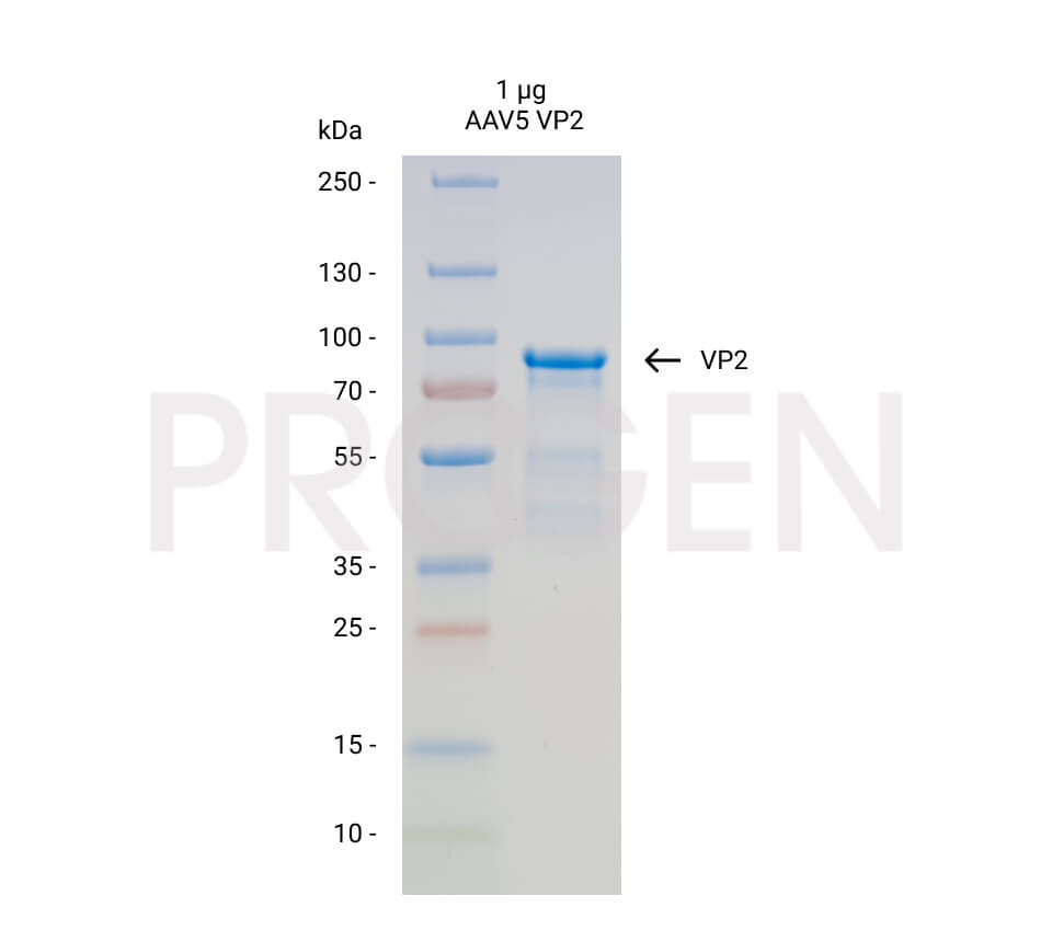 AAV5 VP2, recombinant protein
