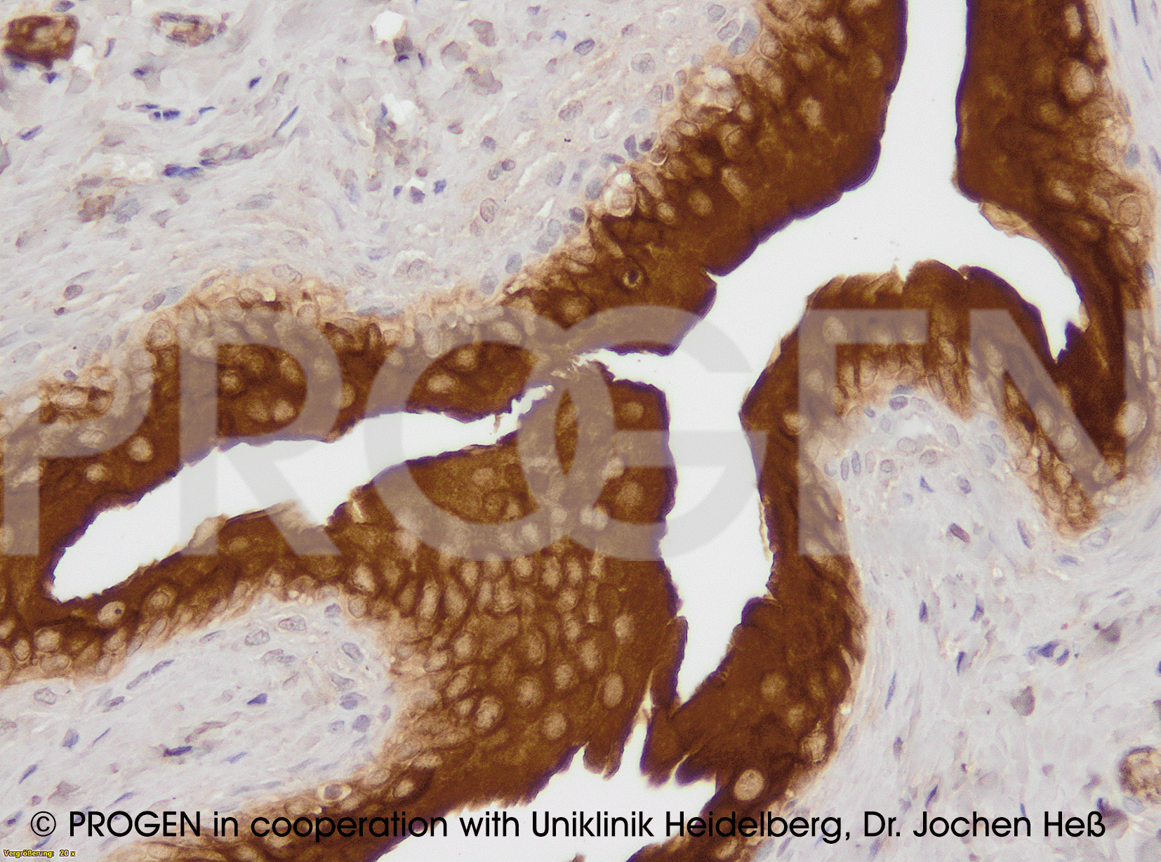 anti-Uroplakin III mouse monoclonal, AU1, lyophilized, purified