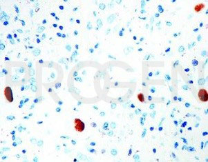 anti-Cytomegalovirus p65 mouse monoclonal, CMV-224, purified