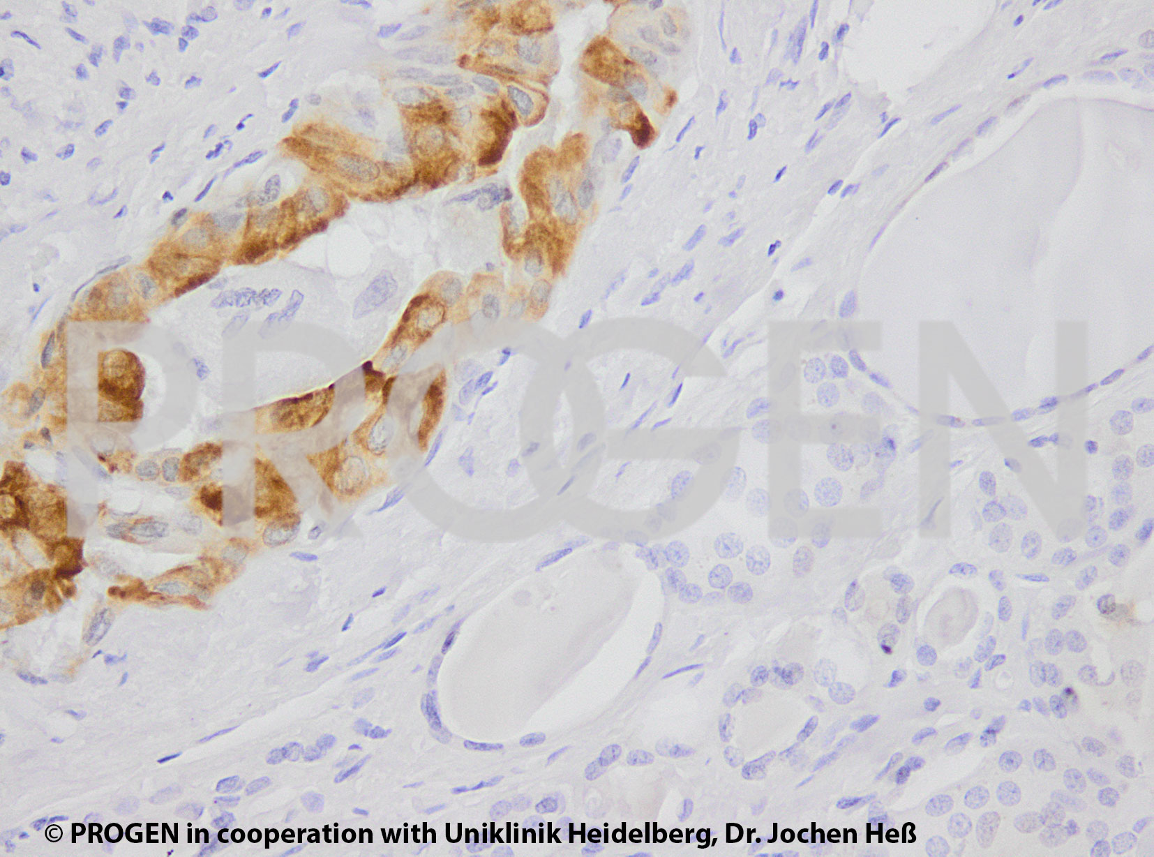 anti-Keratin K7 mouse monoclonal, Ks7.18, lyophilized, purified