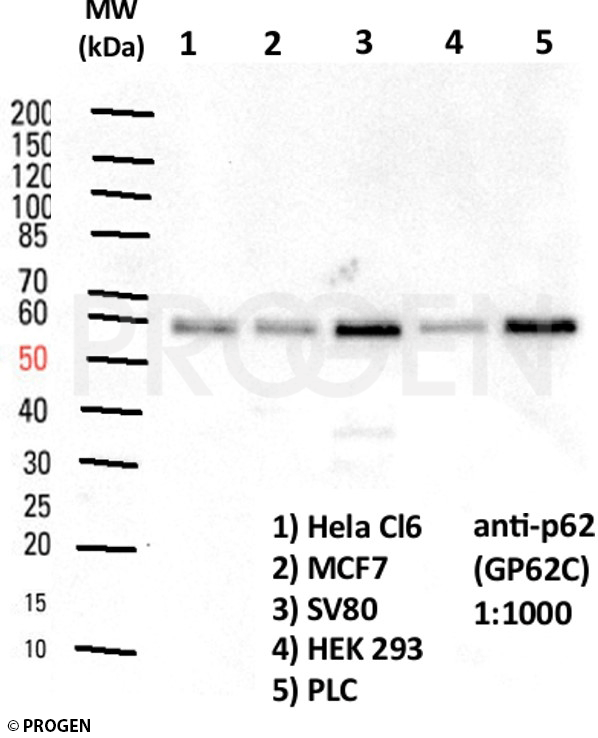 anti-p62/ SQSTM1 (C-terminus) guinea pig polyclonal + anti-guinea pig IgG HRP set