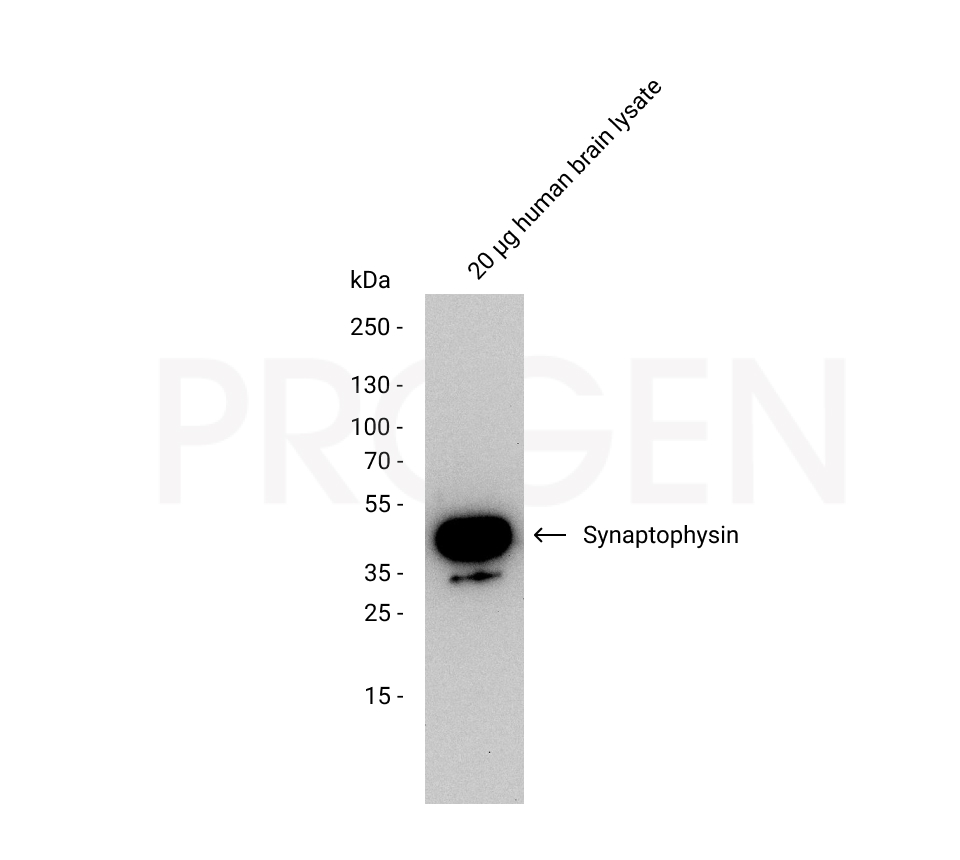 anti-Synaptophysin mouse monoclonal, SY38, lyophilized, purified