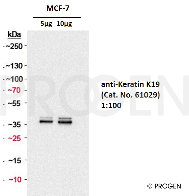 anti-Keratin K19 mouse monoclonal, Ks19.2 (Z105.6), liquid, purified, sample