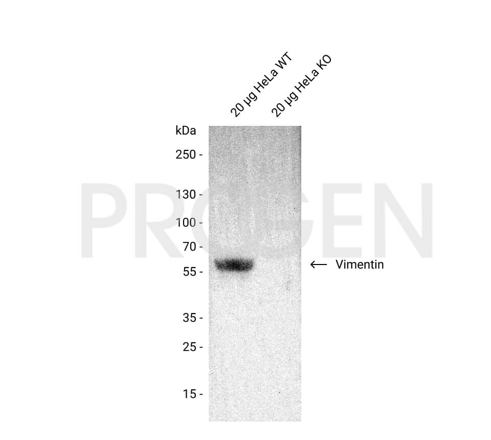 anti-Vimentin mouse monoclonal, XL-VIM-14.13, supernatant