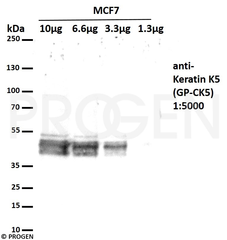 anti-Keratin K5 guinea pig polyclonal, serum