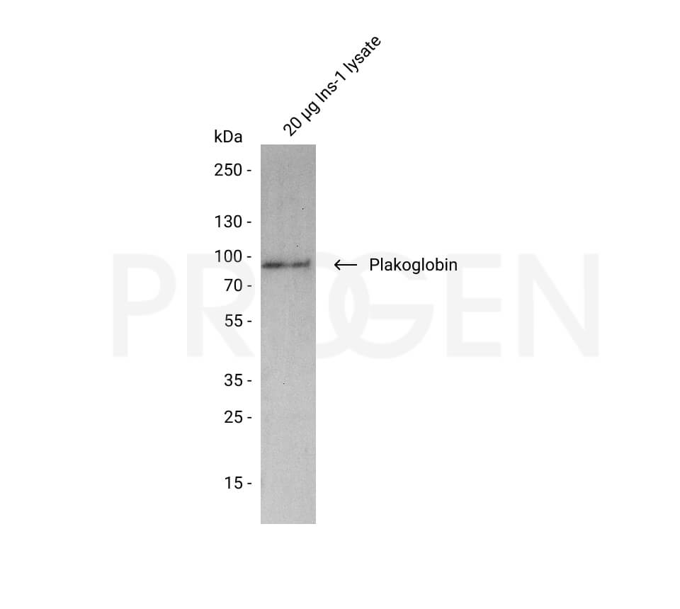 anti-Plakoglobin mouse monoclonal, PG 5.1, lyophilized, purified