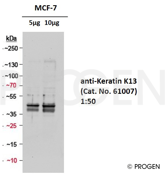Positive western blot control: anti-Keratin K13 antibody