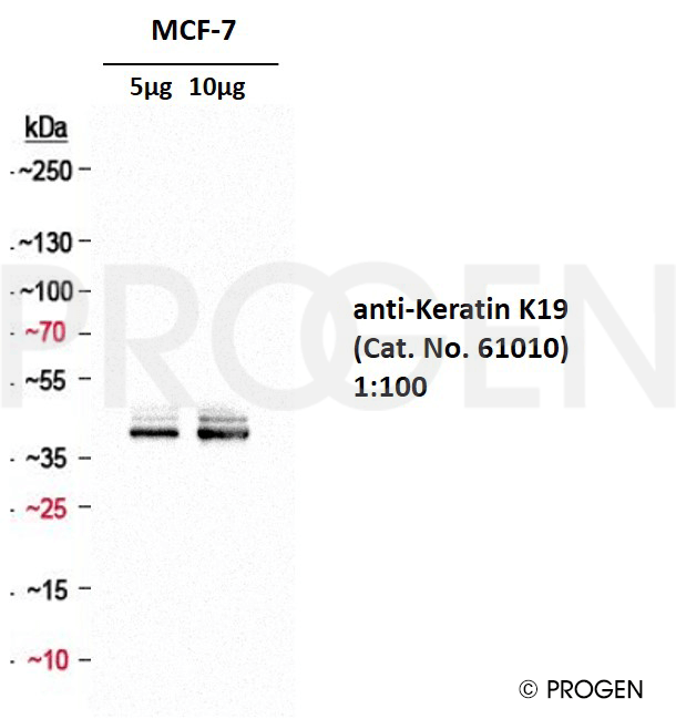 Positive western blot control: anti-Keratin K19 antibody