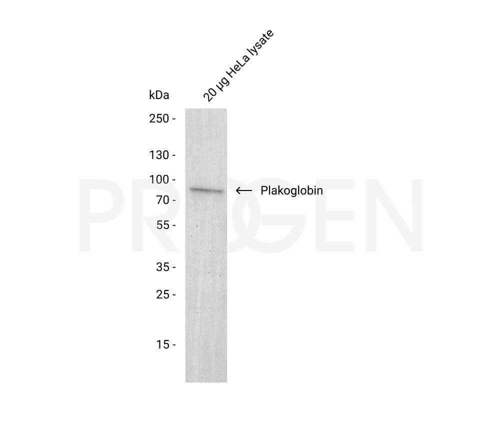 anti-Plakoglobin mouse monoclonal, PG 5.1, liquid, purified, sample